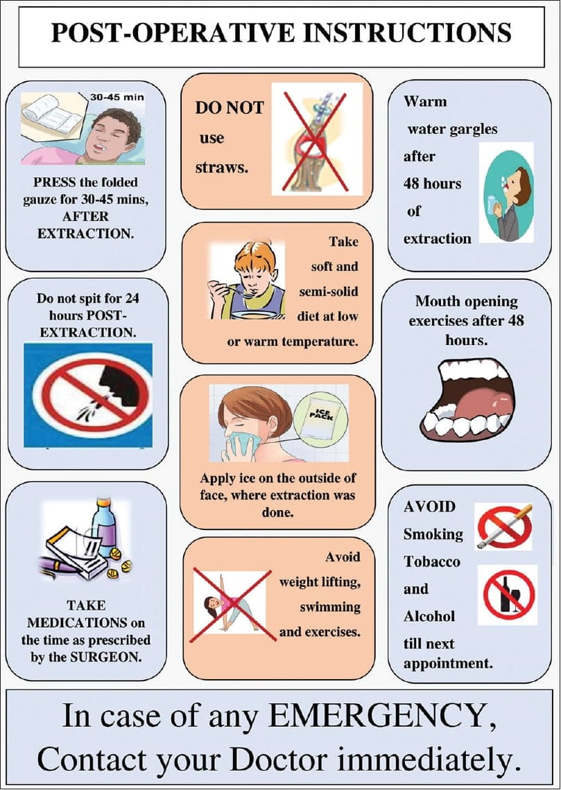 Dental Surgery Aftercare Guidance