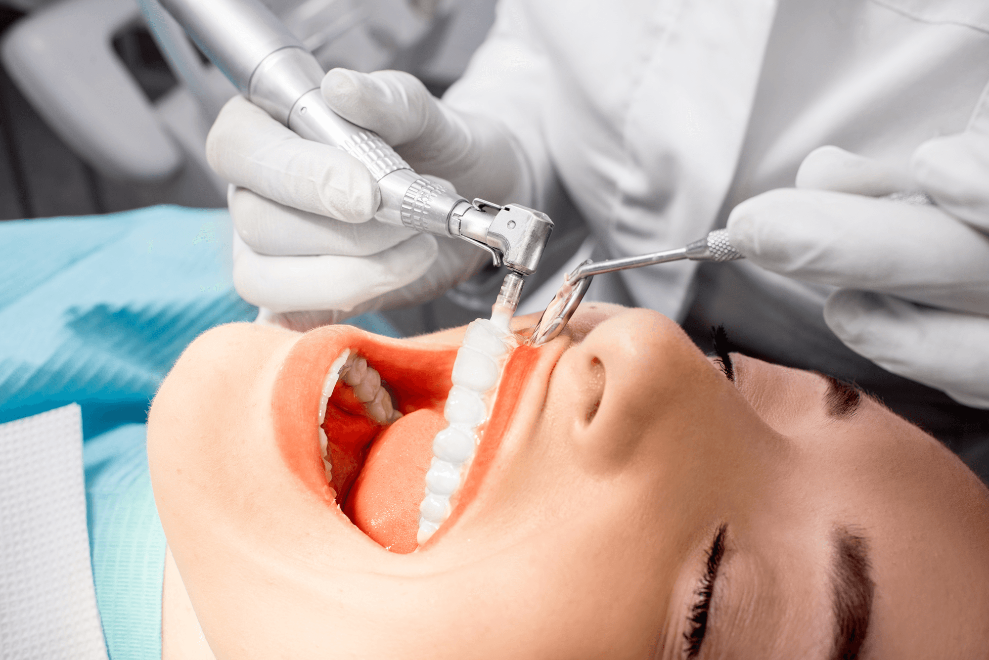 The Power of Professional Teeth Cleaning: Why Your Smile Deserves Expert Care Beyond Your Toothbrush