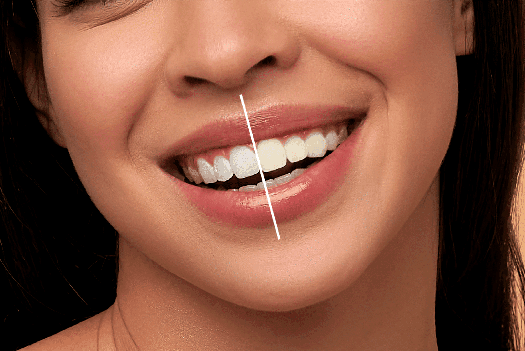 Professional Teeth Whitening: Transform Your Smile with Science-Backed Brightening That Really Works