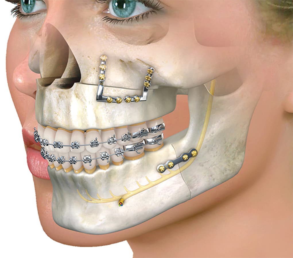 Oral Surgery