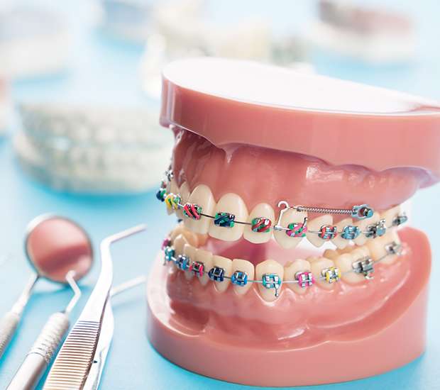 Orthodontic Treatment