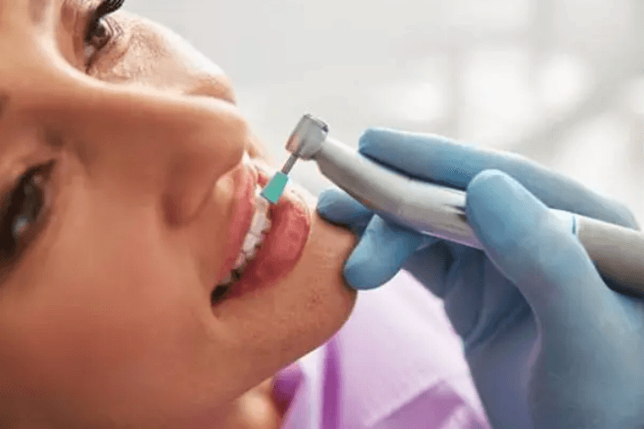 Dental Cleaning During Checkup