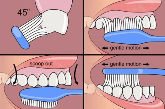 Correct Home Oral Hygiene