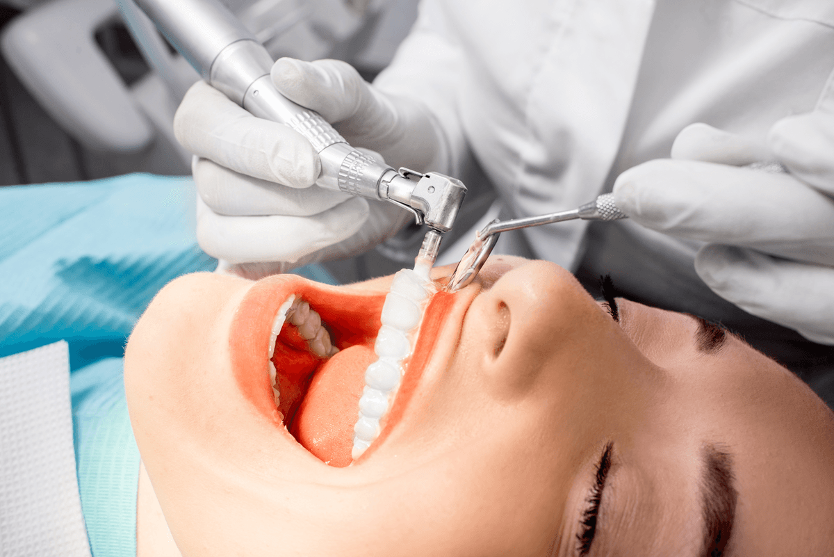 Professional Teeth Cleaning