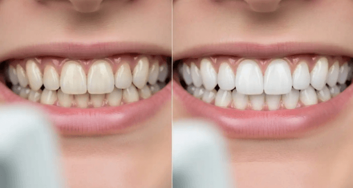 Happy Patient After Teeth Cleaning