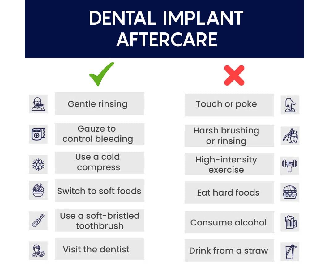 Dental Implant Illustration